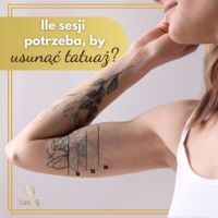 kliniki usuwaj  pieprzyki warszawa LaserQ Clinic - usuwanie znamion, blizn, depilacja laserowa Warszawa Wilanów